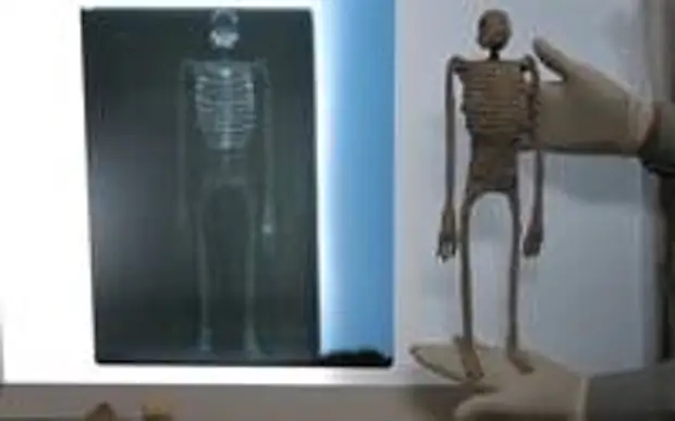 Мумия E.B. (справа) и её рентгенограмма (слева)