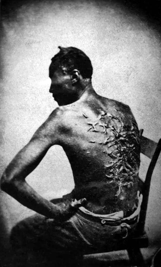 21. Бывший раб показывает свои шрамы от битья, штат Луизиана США, 1863 г. исторические фотографии, история, фото