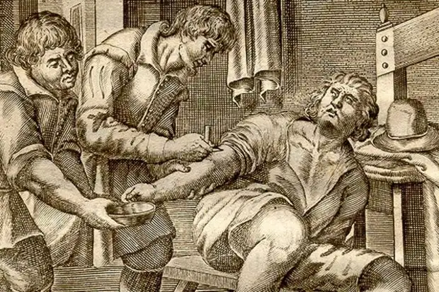 Какие раны могли лечить врачи Средневековья?