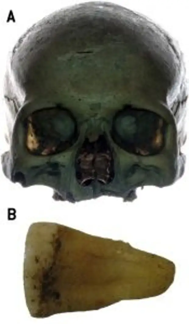 Предполагаемый череп Яна Кохановского (А) и зуб, использованный для генетического анализа (В)