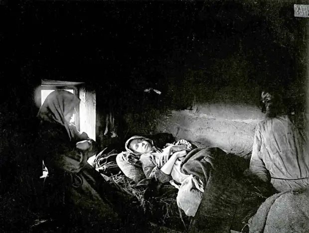 Ребенок больной сыпным тифом в городе Княгинин. 