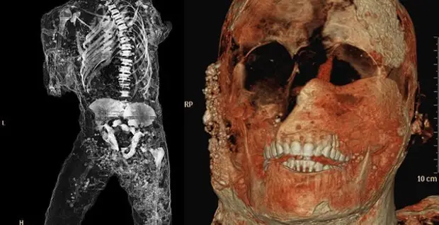 Ученые с помощью современных технологий сформировали изображения людей, погибших в Помпеях более 1900 лет назад.